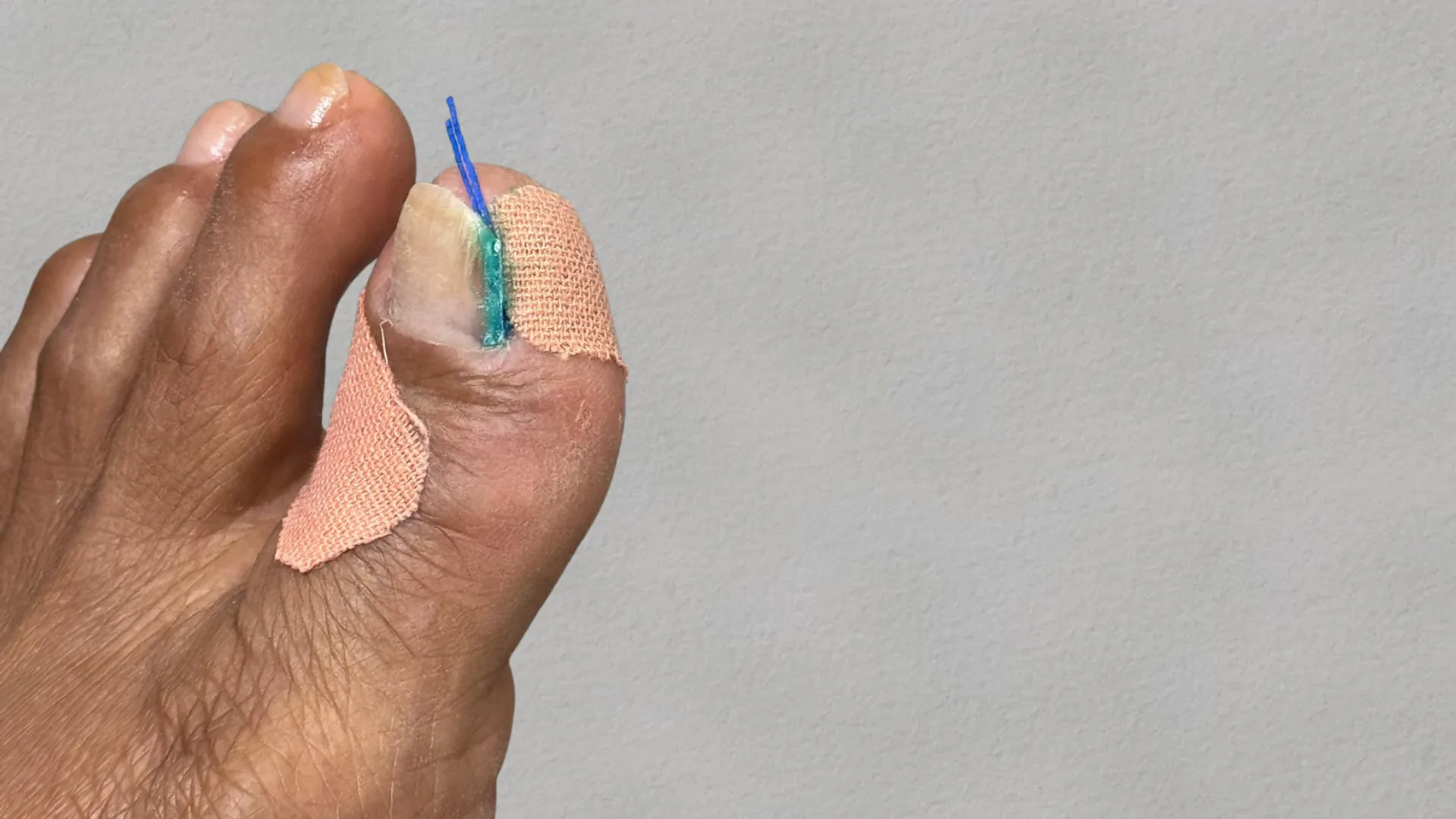 Protocolo de Atendimento Grau I
