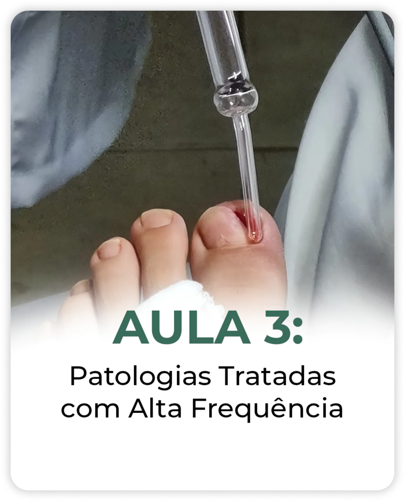 Aula 3